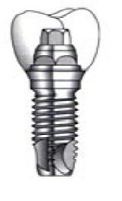 Dental Implant